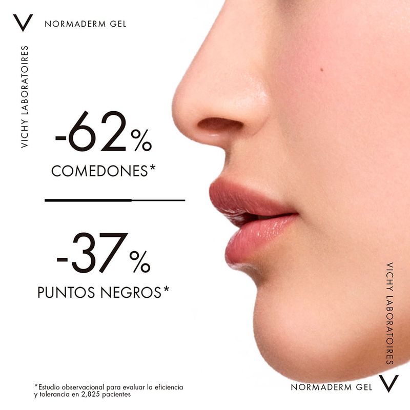 frontal