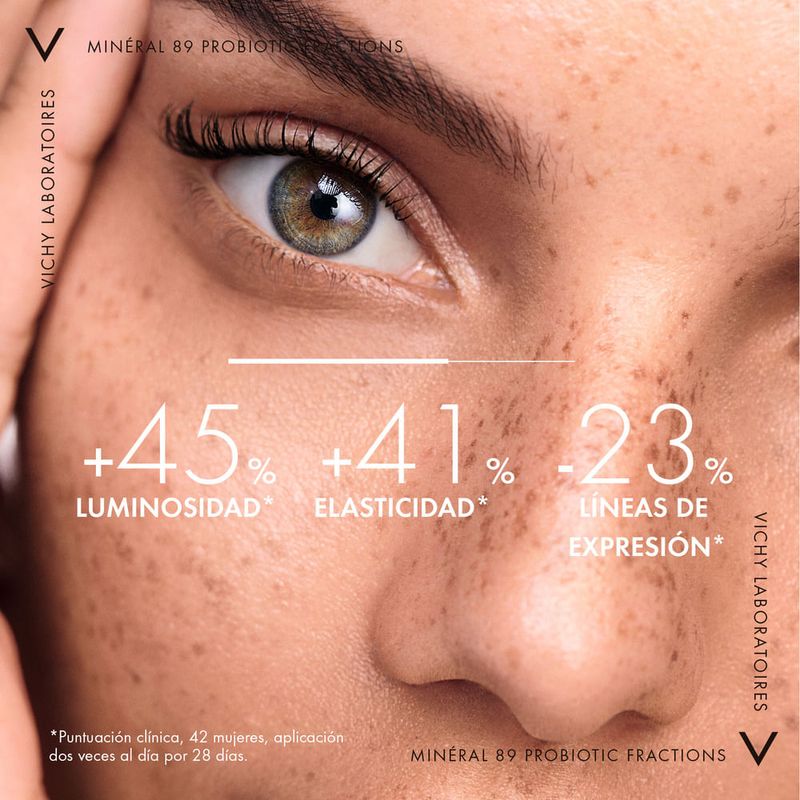 FRONTAL