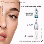 FRONTAL